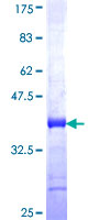 WFDC5 / PRG5 Protein - 12.5% SDS-PAGE Stained with Coomassie Blue.