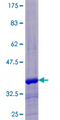 WFDC6 Protein - 12.5% SDS-PAGE of human WFDC6 stained with Coomassie Blue