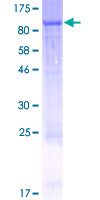 WFIKKN2 / GASP-1 Protein - 12.5% SDS-PAGE of human WFIKKN2 stained with Coomassie Blue