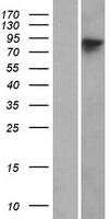 WHAMM Protein - Western validation with an anti-DDK antibody * L: Control HEK293 lysate R: Over-expression lysate