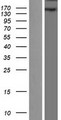 WHSC1 / NSD2 Protein - Western validation with an anti-DDK antibody * L: Control HEK293 lysate R: Over-expression lysate