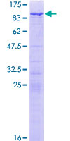 WHSC1 / NSD2 Protein - 12.5% SDS-PAGE of human WHSC1 stained with Coomassie Blue