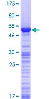WIBG Protein - 12.5% SDS-PAGE of human WIBG stained with Coomassie Blue