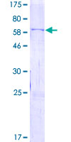 WIF1 Protein - 12.5% SDS-PAGE of human WIF1 stained with Coomassie Blue