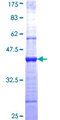WIF1 Protein - 12.5% SDS-PAGE Stained with Coomassie Blue.