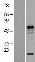 WIPF1 / WIP Protein - Western validation with an anti-DDK antibody * L: Control HEK293 lysate R: Over-expression lysate