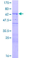 WIPF1 / WIP Protein - 12.5% SDS-PAGE of human WASPIP stained with Coomassie Blue