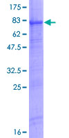 WIPI2 Protein - 12.5% SDS-PAGE of human WIPI2 stained with Coomassie Blue