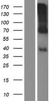 WISP3 Protein - Western validation with an anti-DDK antibody * L: Control HEK293 lysate R: Over-expression lysate
