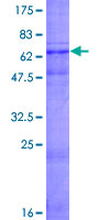 WISP3 Protein - 12.5% SDS-PAGE of human WISP3 stained with Coomassie Blue