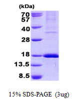 WLS / GPR177 Protein