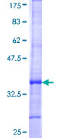 WNK1 Protein - 12.5% SDS-PAGE Stained with Coomassie Blue.