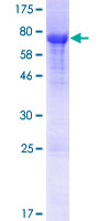 WNK1 Protein - 12.5% SDS-PAGE Stained with Coomassie Blue