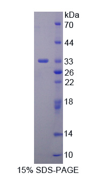 WNK1 Protein - Recombinant  WNK Lysine Deficient Protein Kinase 1 By SDS-PAGE