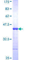 WNK3 / PRKWNK3 Protein - 12.5% SDS-PAGE Stained with Coomassie Blue.