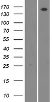 WNK4 Protein - Western validation with an anti-DDK antibody * L: Control HEK293 lysate R: Over-expression lysate
