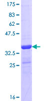WNK4 Protein - 12.5% SDS-PAGE Stained with Coomassie Blue.