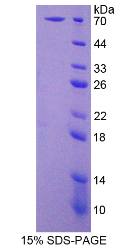 WNT16 Protein - Recombinant  Wingless Type MMTV Integration Site Family, Member 16 By SDS-PAGE