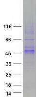 WNT16 Protein - Purified recombinant protein WNT16 was analyzed by SDS-PAGE gel and Coomassie Blue Staining