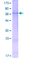 WNT2 / IRP Protein - 12.5% SDS-PAGE of human WNT2 stained with Coomassie Blue