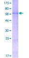 WNT2 / IRP Protein - 12.5% SDS-PAGE of human WNT2 stained with Coomassie Blue