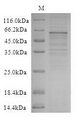WNT2B Protein - (Tris-Glycine gel) Discontinuous SDS-PAGE (reduced) with 5% enrichment gel and 15% separation gel.