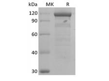 WNT3A Protein - Recombinant Human Wnt3a/Wnt-3a