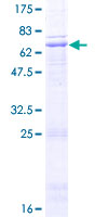 WNT4 Protein - 12.5% SDS-PAGE of human WNT4 stained with Coomassie Blue