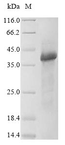 WNT5A Protein - (Tris-Glycine gel) Discontinuous SDS-PAGE (reduced) with 5% enrichment gel and 15% separation gel.