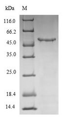 WNT5A Protein - (Tris-Glycine gel) Discontinuous SDS-PAGE (reduced) with 5% enrichment gel and 15% separation gel.