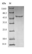 WNT5A Protein - (Tris-Glycine gel) Discontinuous SDS-PAGE (reduced) with 5% enrichment gel and 15% separation gel.