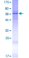 WNT5A Protein - 12.5% SDS-PAGE of human WNT5A stained with Coomassie Blue