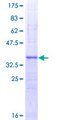 WNT5A Protein - 12.5% SDS-PAGE Stained with Coomassie Blue.