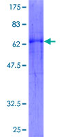 WNT5B Protein - 12.5% SDS-PAGE of human WNT5B stained with Coomassie Blue