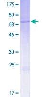 WNT6 Protein - 12.5% SDS-PAGE of human WNT6 stained with Coomassie Blue