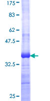 WNT7B Protein - 12.5% SDS-PAGE Stained with Coomassie Blue.
