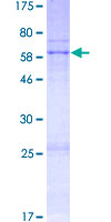 WNT9B / WNT15 Protein - 12.5% SDS-PAGE of human WNT9B stained with Coomassie Blue