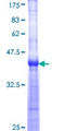WRN Protein - 12.5% SDS-PAGE Stained with Coomassie Blue.