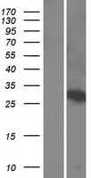 WSB1 Protein - Western validation with an anti-DDK antibody * L: Control HEK293 lysate R: Over-expression lysate