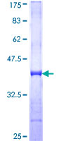 WSB1 Protein - 12.5% SDS-PAGE Stained with Coomassie Blue.