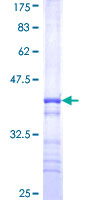 WSB2 Protein - 12.5% SDS-PAGE Stained with Coomassie Blue.