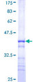 WSB2 Protein - 12.5% SDS-PAGE Stained with Coomassie Blue.
