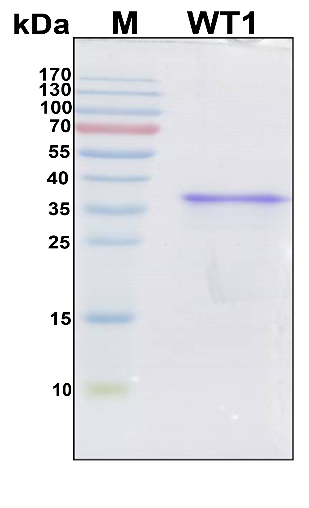 WT1 / Wilms Tumor 1 Protein - SDS-PAGE under reducing conditions and visualized by Coomassie blue staining
