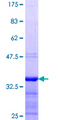 WT1 / Wilms Tumor 1 Protein - 12.5% SDS-PAGE Stained with Coomassie Blue.