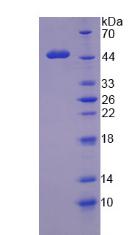 WT1 / Wilms Tumor 1 Protein - Recombinant Wilms Tumor Protein (WT1) by SDS-PAGE