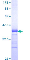 WT5 / POU6F2 Protein - 12.5% SDS-PAGE Stained with Coomassie Blue.