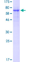 WTAP Protein - 12.5% SDS-PAGE of human WTAP stained with Coomassie Blue