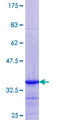 WTAP Protein - 12.5% SDS-PAGE Stained with Coomassie Blue.
