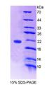 WTAP Protein - Recombinant Wilms Tumor 1 Associated Protein By SDS-PAGE