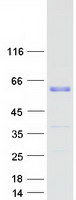 WTAP Protein - Purified recombinant protein WTAP was analyzed by SDS-PAGE gel and Coomassie Blue Staining
